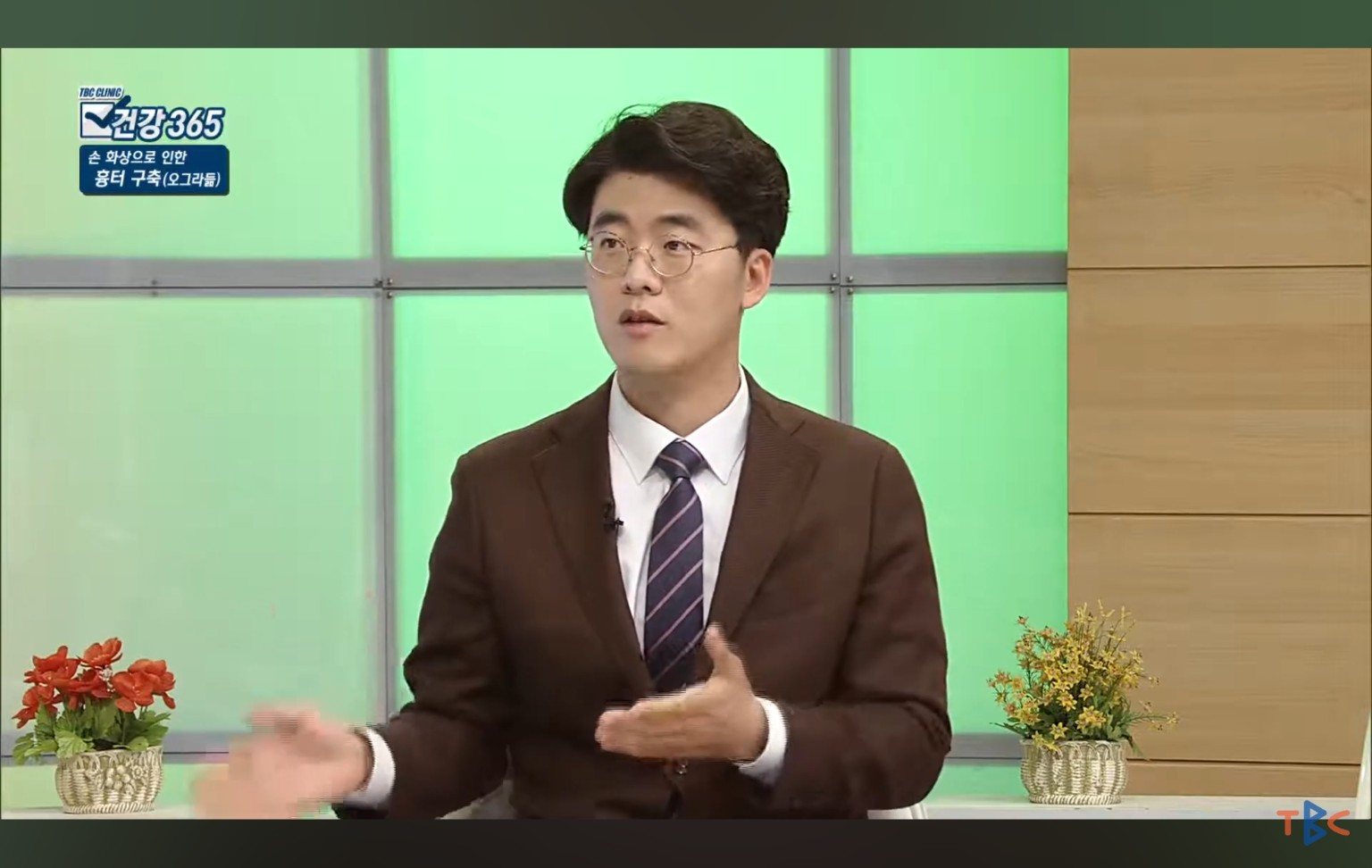 TBC 건강365에서 손 화상으로 인한 흉터 구축을 설명하는 최진희 원장